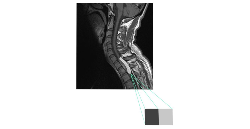 MRI Rad CNR mri-rad-cnr